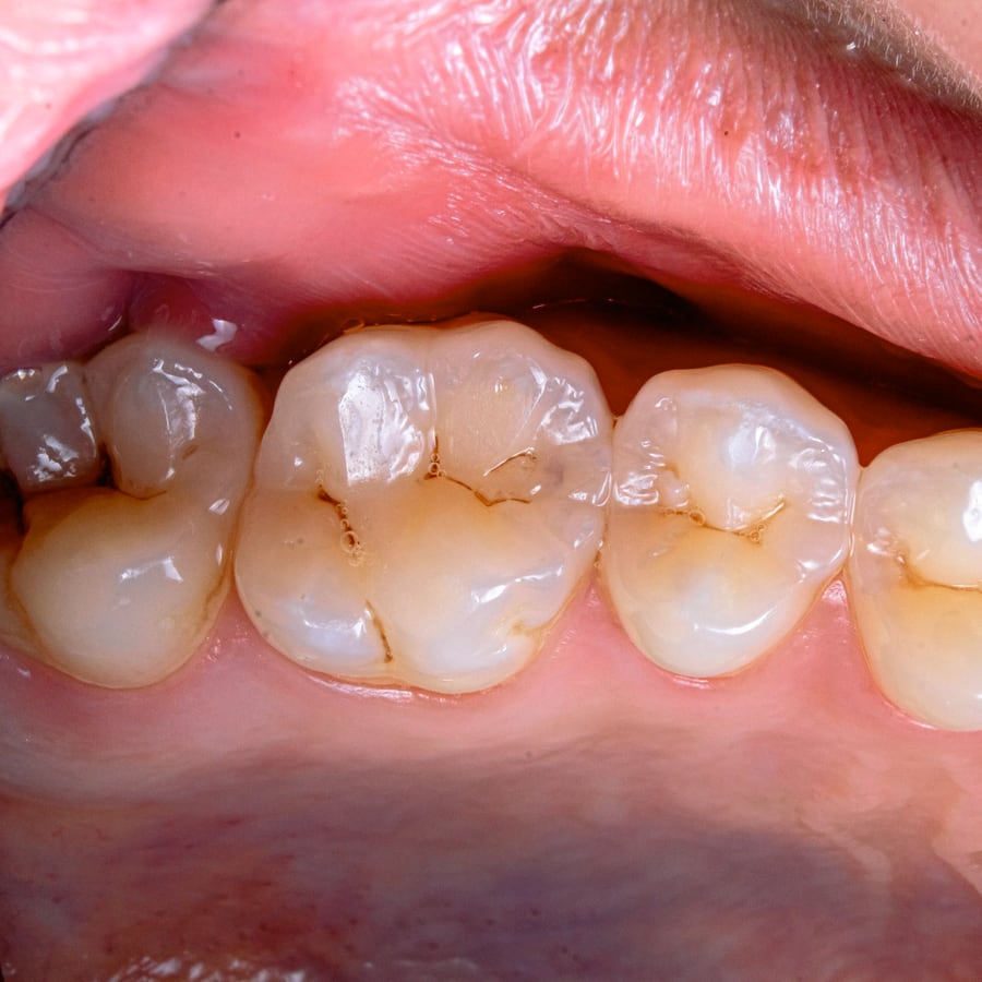 Konservative Zahnbehandlung - Zahnärztin in Hamburg Barmbek