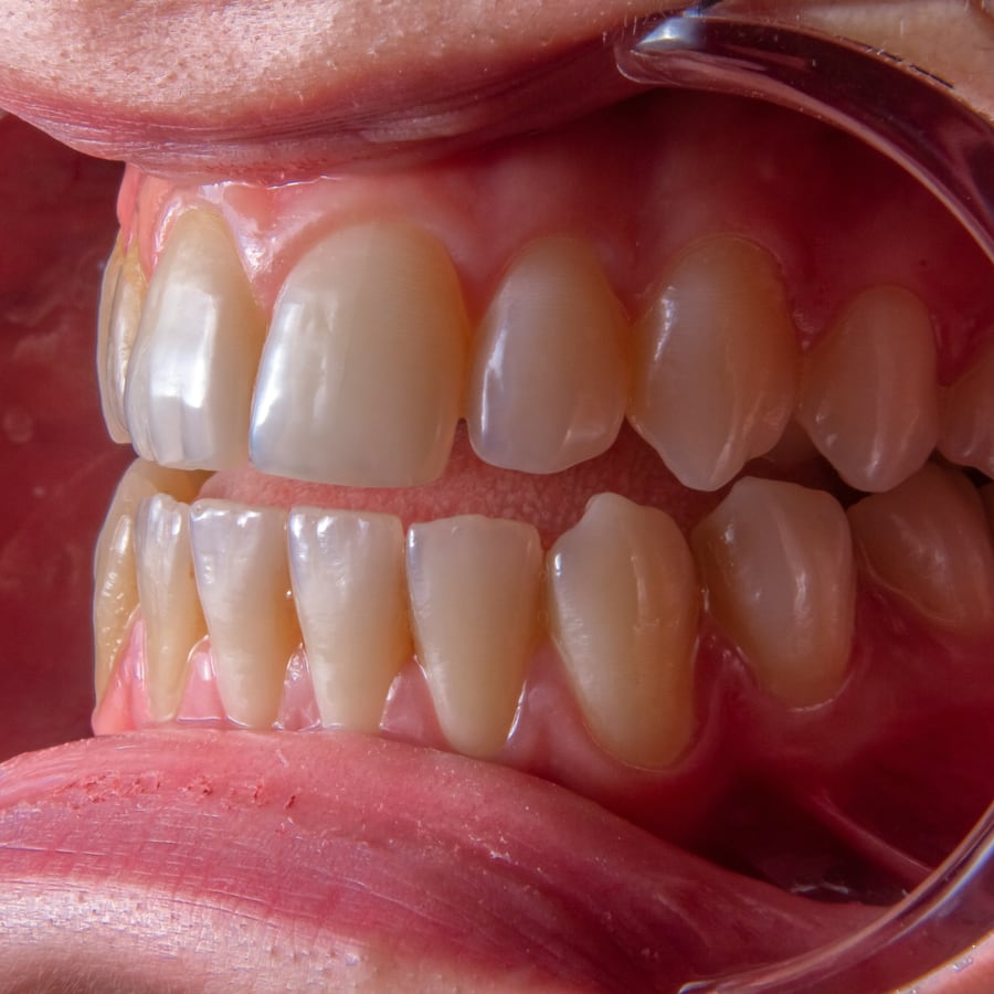 Parodontologie - Zahnärztin in Hamburg Barmbek